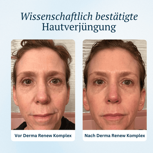 Derma Renew Komplex